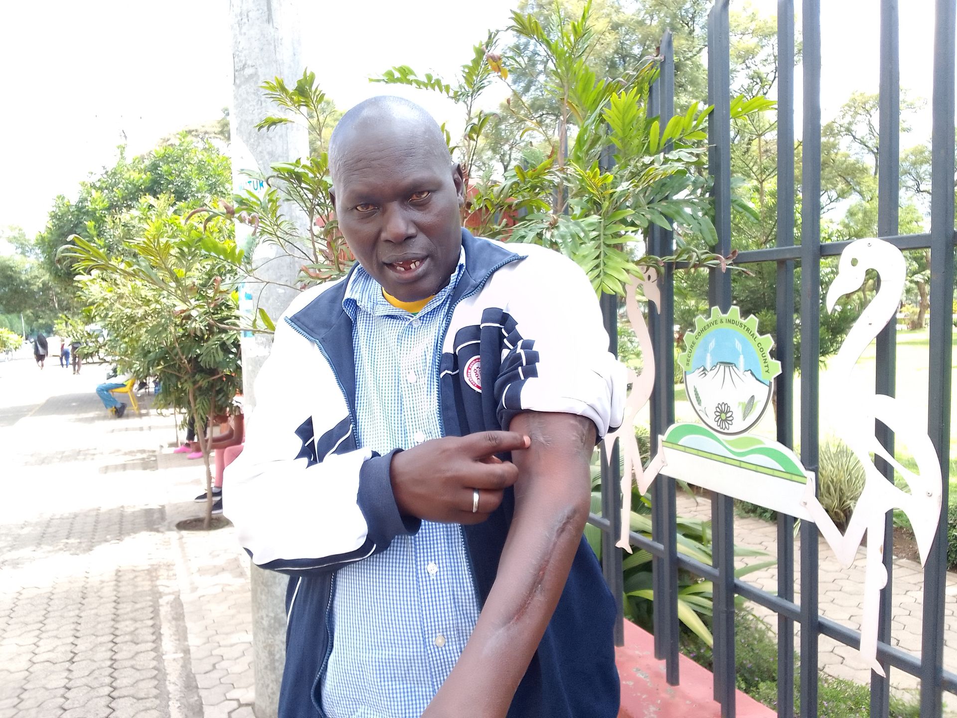 William Sawe: I have to live with metal implants and a paralysed arm after a horrific car accident