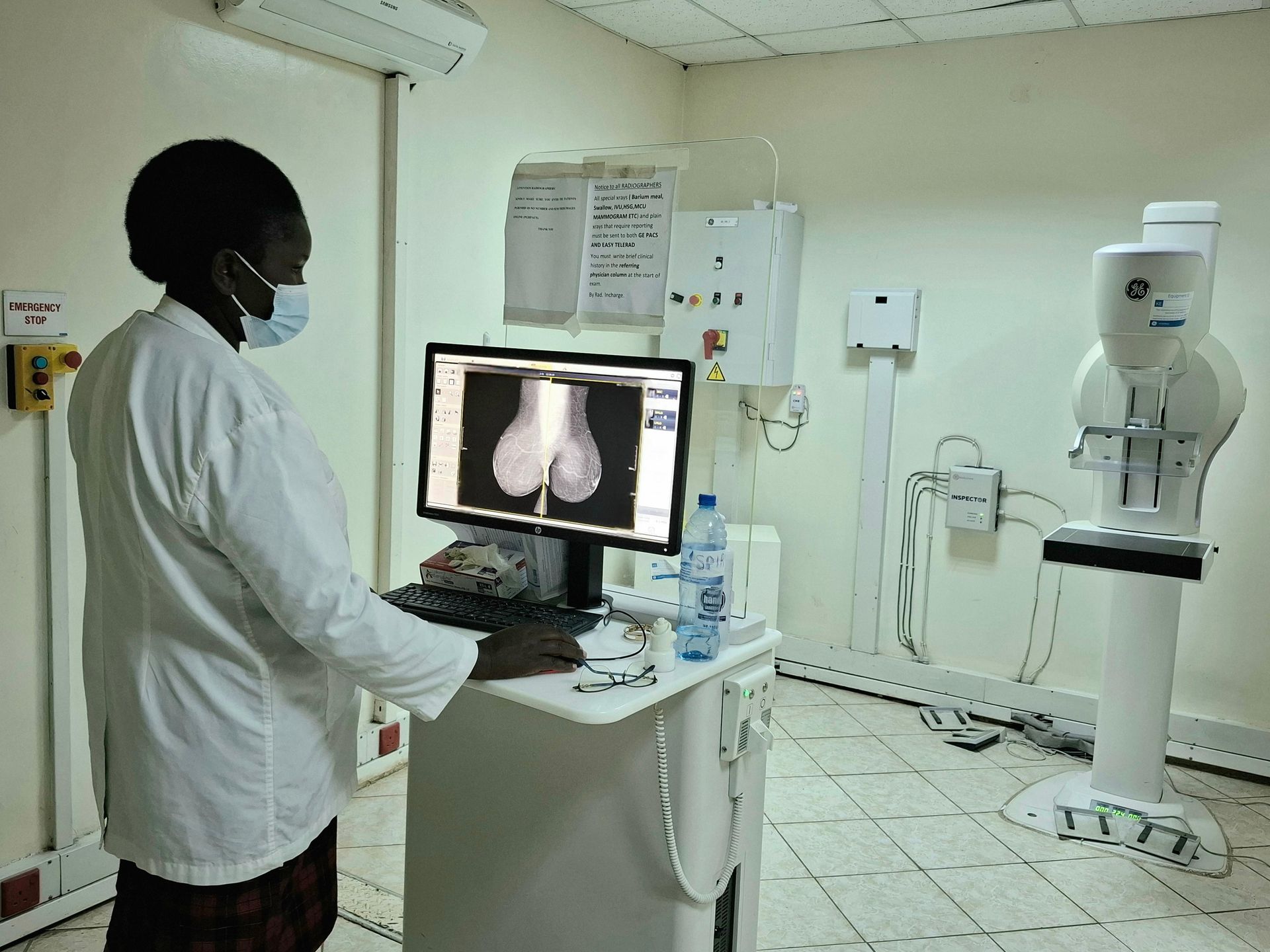 Why doctors urge Nakuru women over 40 to get mammograms annually